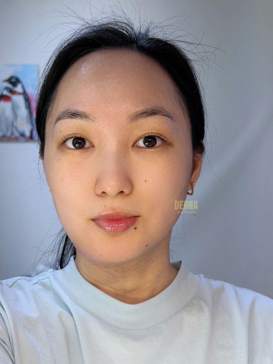 Pore & Scar Solution after